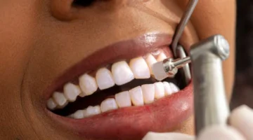 بنسبة مرتفعة.. حالة أسنانك تحدد احتمالية تعرضك لخطر الوفاة المبكرة